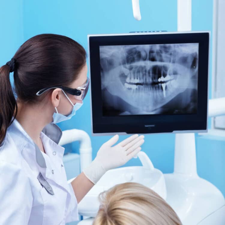 digital x-ray